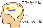 ]n}